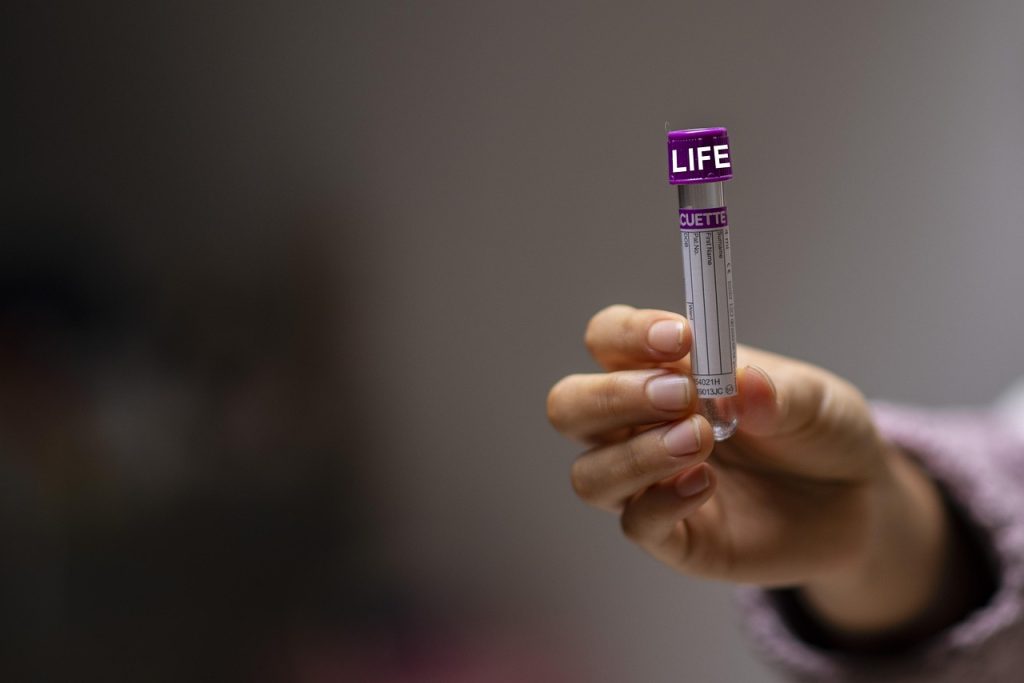Lesão Ulcerada na Pele: O Que É, Causas e Diagnóstico Vascular